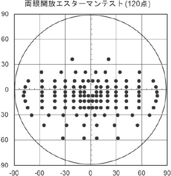 両眼開放エスターマンテスト(120点)